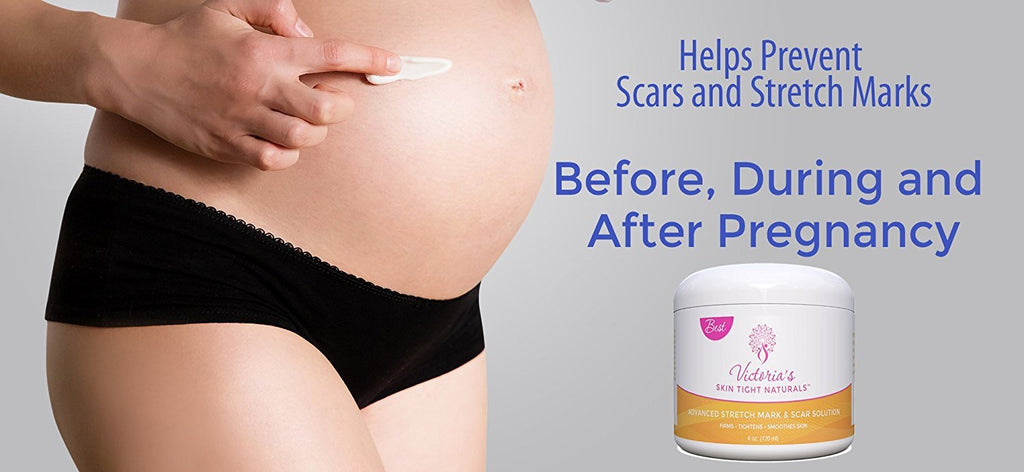 pregnancy before, after and during pregnancy Best Stretch Marks Removal Cream, Prevent & Reduce Marks