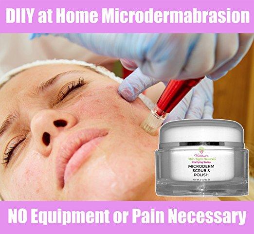 Microdermabrasion Skin Polish